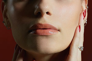 コラーゲン注入